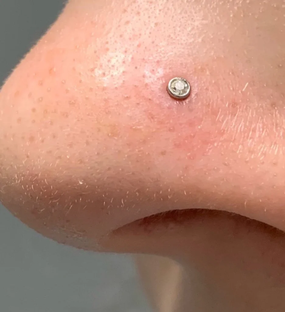 How To Tell if Your Nose Piercing Is Healed?